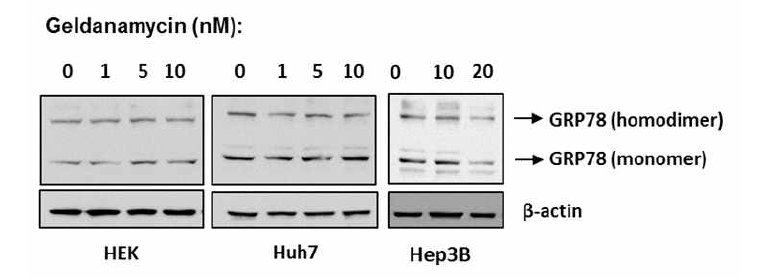 HEK, Huh7, Hep3B 세포주에서 Geldanamycin에 의한 GRP78 단백질의 발현 변화