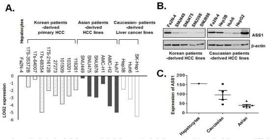환자 유래 간암세포(A), 정상간세포주 및 간암세포주(B), 인종(C)에 따른 ASS1 발현량
