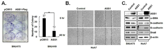 ASS1의 과발현에 따른 세포증식(A), 세포이동(B), 상피중간엽전이 관련 인자 변화(C)