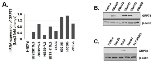 환자 유래 간암세포 구상체에서의 mRNA 발현량(A), 정상간세포주 및 한국인 간암세포주(B), 서양인 간암세포주(C)에 따른 GRP78 단백질의 발현량
