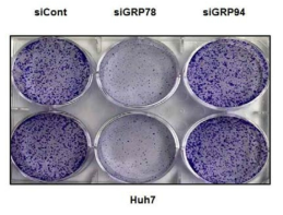 GRP78 발현 감소에 따른 세포 증식 억제
