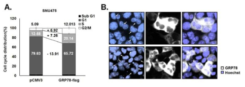 GRP78 발현에 따른 세포주기 변화(A) 및 세포 분열 변화(B)
