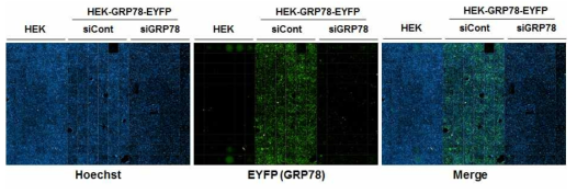 GRP78 siRNA를 이용한 stable cell line 검증