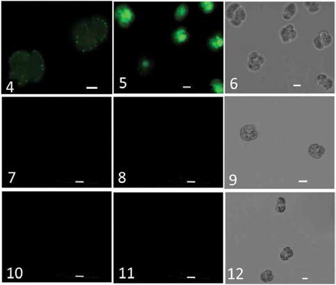 Fluorescence microscopy observations of the NGU04 (Figs 4, 5, 6), SUO-1 (Figs 7, 8, 9) and 2411 (Figs 10, 11, 12) strains of Karenia mikimotoi after incubation with MCLA (Figs 4, 7, 10) as a specific fluorescent probe for O2 or CM-H2DCFDA (Figs 5, 8, 11) as a fluorescent probe for H2O2. The cells were observed under phase-contrast (Figs 6, 9, 12). Bars indicate 5 μm