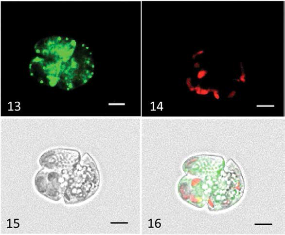 Enlarged photographs of a cell of the Karenia mikimotoi NGU04 strain. Fig. 13. MCLA-derived fluorescence. Fig. 14. Intrinsic fluorescence derived from chlorophyll. Fig. 15. Phase-contrast observation. Fig. 16. Picture combining the three observations. Bars indicate 5 μm