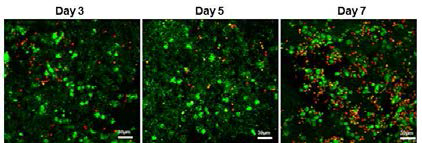면역조직기질세포(SNEC)와 전구T세포를 복합 나노섬유 지지체에 3, 5 및 7일 동안 공배양한 후, 공초점레이저현미경으로 관찰한 결과(Green: Ia, Red: CD4, CD8)