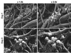 면역조직기질세포-전구T세포를 1일 및 3일 동안 공배양한 주사전자현미경 사진