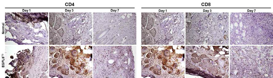 정상 및 EGFL8tg 마우스 피부이식모델에서 1, 3 및 7일째 CD4 및 CD8 T세포의 침윤 분석