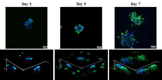 복합 하이드로겔 지지체에서 마우스T세포림프종세포주(EL4)의 스페로이드 형태를 관찰한 공초점레이저현미경 사진(Green : F-actin, Blue : DAPI)