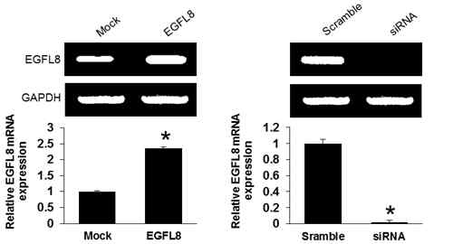 EGFL8 및 EGFL8-siRNA가 피막밑상피세포(SNEC)에 형질주입이 제대로 이루어 졌는지 확인한 결과