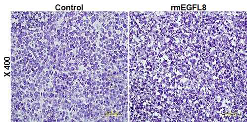 마우스T세포림프종 유도 생쥐에 재조합 EGFL8 단백질을 정맥주사한 후 EGFL8의 효과 확인한 결과 (H-E 염색)