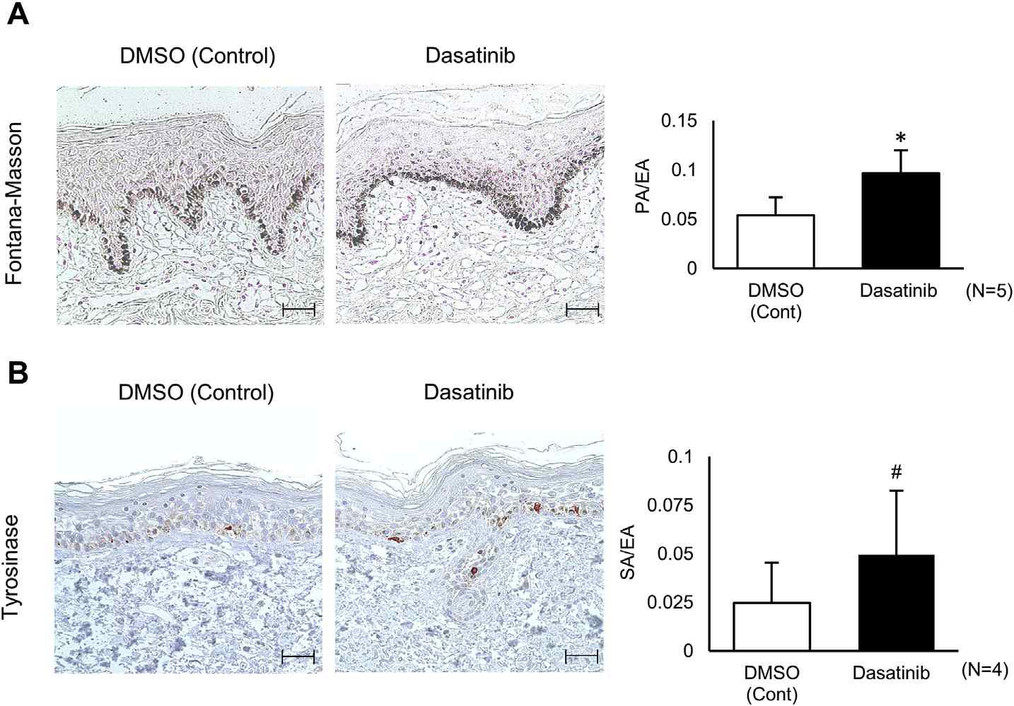 Dasatinib induces cutaneous pigmentation. (A) Pigmentation of ex vivo human skin was visualized by Fontana-Masson staining. The pigmented area/epidermal area (PA/EA) ratio was measured by an image analysis (scale bar, 100 mm). (B) The tyrosinase expression level was detected by immunohistochemical staining. The stained area/epidermal area (SA/EA) ratio was measured (scale bar, 100 mm). Data are presented as the mean ± SD (*p < 0.01 vs. control, #p < 0.05 vs. control)