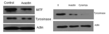 Effect of cyramza and avastin in expressions of MITF and tyrosinase of B16 melanoma cells