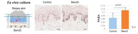 Screening system using ex vivo human skin in the presence of Bend3 cells