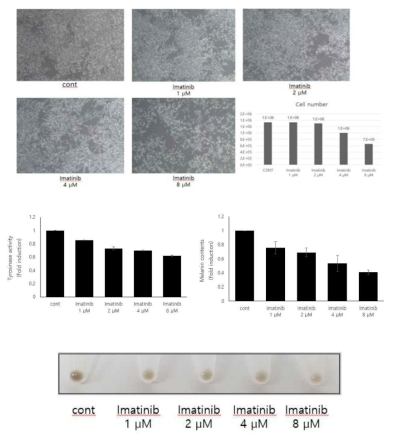 Antimelanogenic effects of imatinib in normal human melanocytes