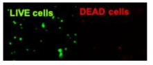 종양세포를 고정시키고 7일 뒤 live/dead staining 결과