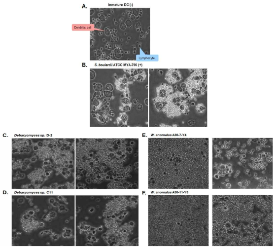 미성숙 수지상 세포와 장류 유래 효모 균주들의 반응 후 현미경 사진. (A) 미성숙 수지상 세포(immature DCs, iDCs) (B) 양성 대조군 S. boulardii와 반응시킨 수지상 세포 (C) Debaryomyces sp. D-2와 반응시킨 수지상 세포 (D) Debaryomyces sp. C0-11-Y2와 반응시킨 수지상 세포 (E) W. anomalus A30-7-Y4와 반응시킨 수지상 세포 (F) W. anomalus A30-11-Y3과 반응시킨 수지상 세포