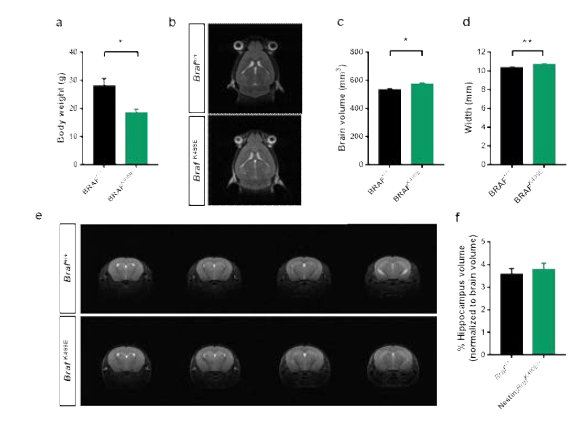 신경 줄기 세포 특이적 BRAFK499E 발현이 뇌 발달에 미치는 영향 a 몸무게 b Structural MRI: horizontal 단면의 대표 이미지 c 뇌의 부피 d 뇌의 가로 길이 e Structural MRI: 해마 부위의 대표 이미지 f 해마의 부피