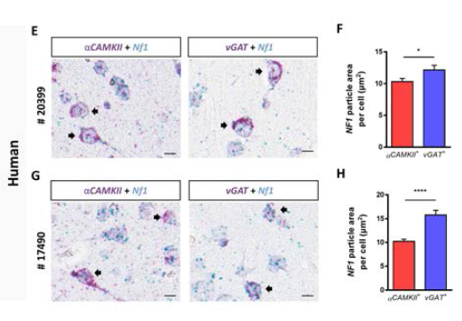 마우스와 human 조직에서 세포타입 특이적인 NF1의 mRNA양. 마우스와 휴먼조직에서 모두 억제성 신경세포보다 흥분성 신경세포에 NF1의 mRNA 발현양이 높은 것을 확인함. (A-D) 마우스 조직 (E-H) human 조직