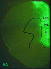 생쥐 뇌측 전전두엽에 특이적으로 발현된 바이러스. SHP2 돌연변이 뒤에 부착된 HA 염색을 통해 확인하였
