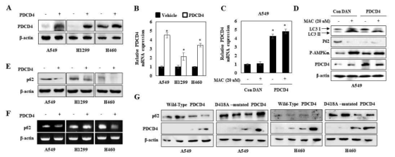 PDCD4 과발현 세포 구축 및 autophagy에 미치는 영향