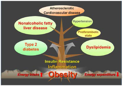 비만 유래 대사질환 (Int. J. Mol. Sci. 2014,15(4);6184) 질환 발병