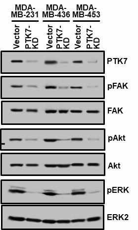 삼중음성유방암 세포들에서 PTK7 knockdown에 의한 세포 성장 및 발암 신호 전달 과정의 저해 분석. 삼중음성유방암 MDA-MB-231 세포, MDA-MB-436 세포 및 MDA-MB-453 세포에서 PTK7 knockdown 후, 세포의 성장과 발암 신호전달에 중요한 역할을 하는 FAK, Akt, ERK의 인산화를 분석함