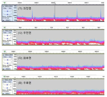 청진부위에 따른 심음 영역과 호흡음 영역은 다소 구분되는 특징을 보임