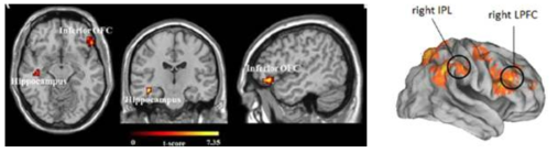 좌) 고위인지 중심 영역인 Frontopolar와 기능적 연결성을 보이는 Default mode network내의 영역들 탐색, 우) Fronto-parietal연결성과 동기부여된 인지기제 처리