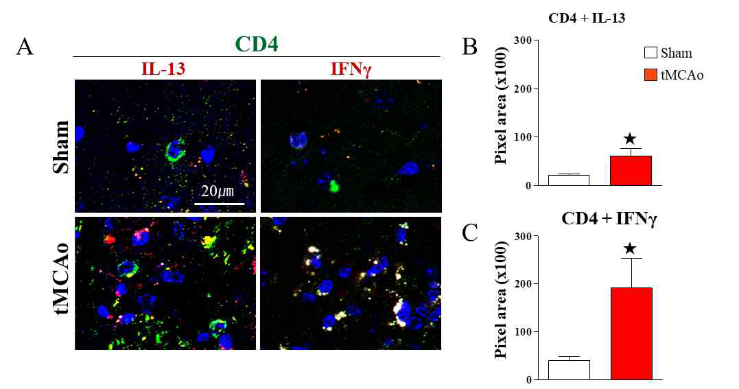 CD4+ T 세포 면역 내 IL-13과 IVF-γ 발현의 증가 확인