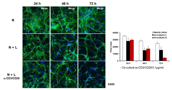 신경세포와 비장세포 공배양 후 신경세포에서 MAP2 발현 확인