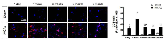 뇌경색 부위에 CD4 T 세포 확인 (2세부 제공)