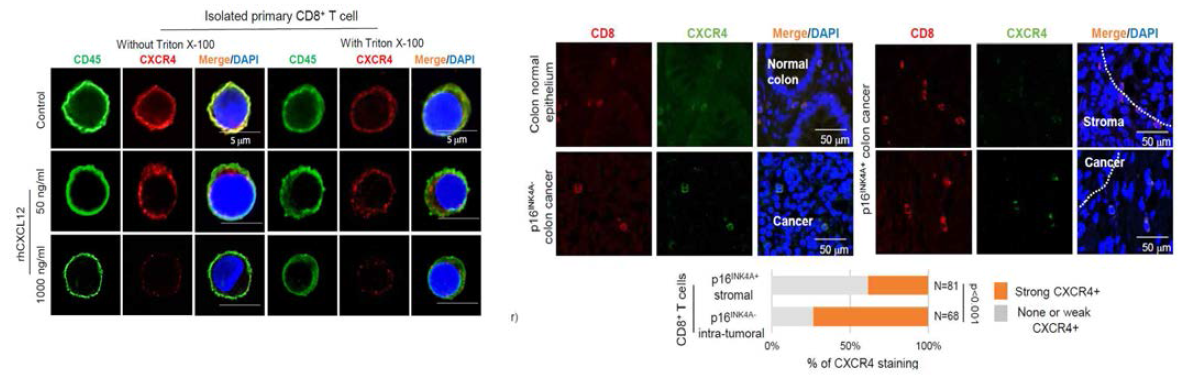 노화 종양세포 유래 CXCL12에 의한 T 세포에서 CXCR4 소실