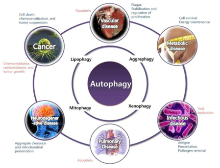 Autophagy 조절 이상이 주로 연구되는 질환