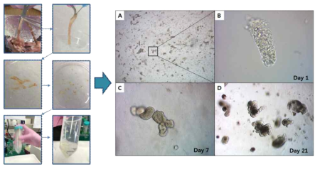 마우스 대장 오가노이드 배양 과정 및 오가노이드의 현미경 사진 ) (A, B, C, D: 시기에 따른 오가노이드의 성장)