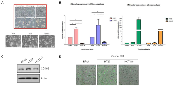 대장암세포주 특성 별 macrophage 분화 유도 경향 분석