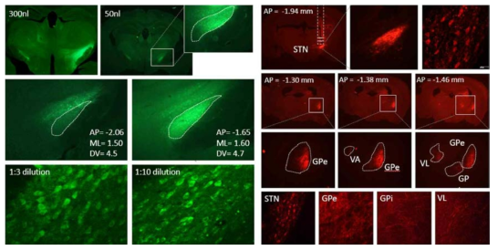 ChrimsonR-tdT(우)에 의한 기저핵 시상하핵 PV 뉴런의 출력 패턴 연구