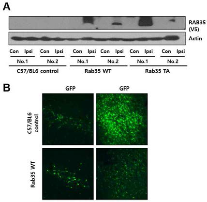 RAB35 과발현 동물 모델에서의 RAB35 단백질 발현 분석