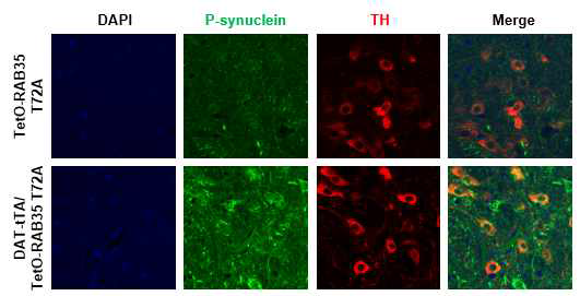 RAB35 T72A 과발현 mouse 뇌속 흑질 내 synuclein phosphorylation 분석