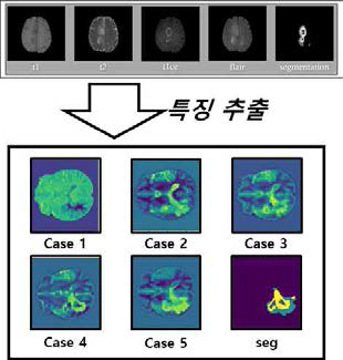 2D MRI 특징 추출