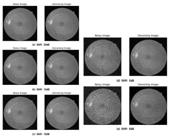 오토인코더 신경망을 활용한 망막 영상의 잡음제거 결과