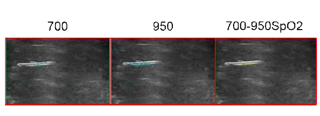 750, 950nm 파장을이용하여 얻은 상대적 산소포화도 영상