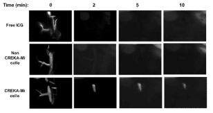 24 hr Post Imaging with targeted bio-imaging agent (CREKA-Micelle), non-targeted bio-imaging agent (non CREKA-Micelle), and free infra-red dye, ICG