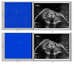 동맥경화반기반 경동맥 광음향 영상(a,b)과 대조군인 정상 경동맥(c,d)