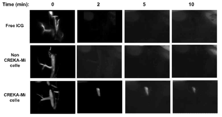 24 hr Post Imaging with targeted bio-imaging agent (CREKA-Micelle), non-targeted bio-imaging agent (non CREKA-Micelle), and free infra-red dye, ICG