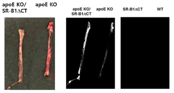 Ex vivo image of the thoracic aorta of mice. Top image is pathologic specimen. Bottom images are NIR image after thrombus targeted bio-imaging agent