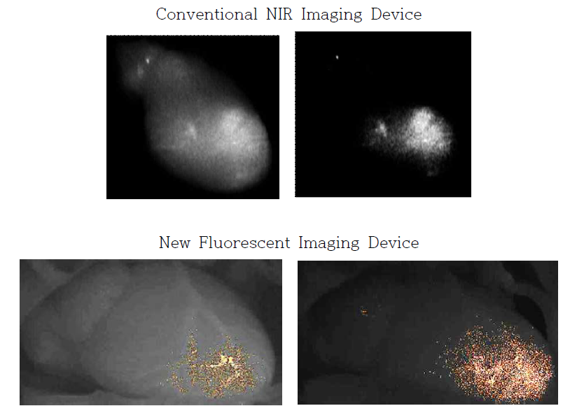 Visualization of left ventricular thrombosis using conventional NIR imaging device and the new fluorescent imaging device