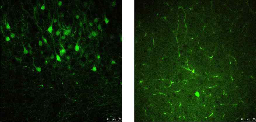 Cleared YFP brain 샘플을 상용 이광자 현미경 영상