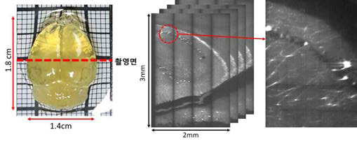 YFP mouse brain 촬영