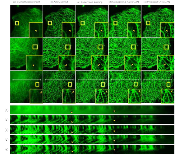 Monkey Kidney Fibroblasts 영상에 적용된 Deconvolution 기법 비교